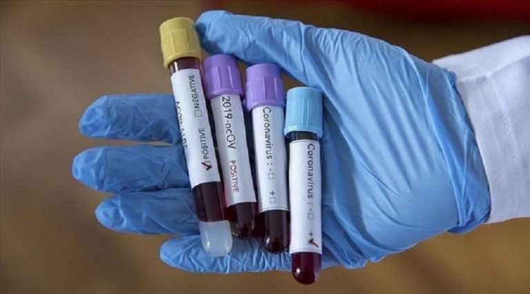 Almanya’dan ‘corona virüsü’ kararı: Türkiye ile yapılan anlaşma kaldırıldı
