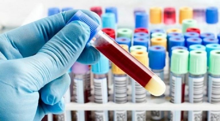 KKTC’den, Türkiye’den gelenlere negatif testlerinde QR kodu şartı getirildi